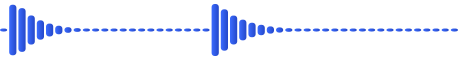Waveform of Low Battery